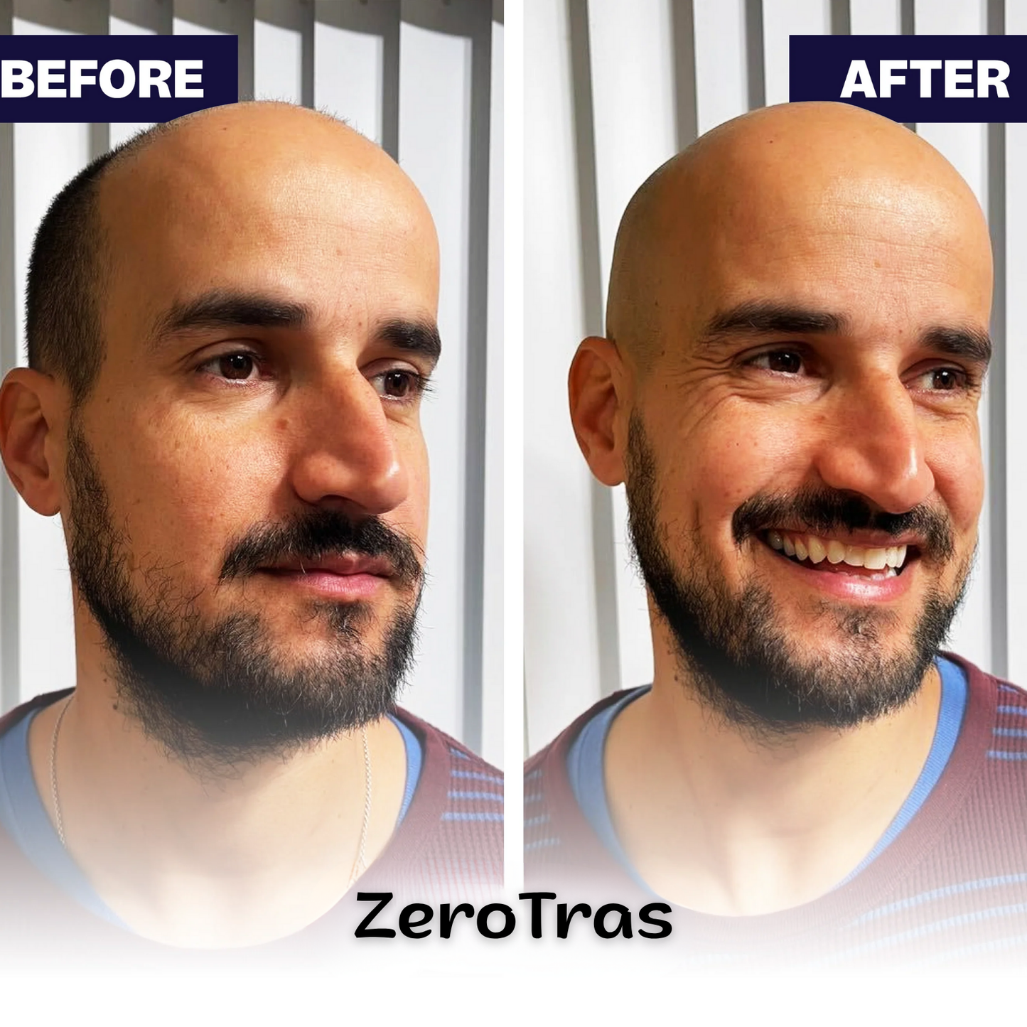 FlexSeries™ 5 Shaver - Men